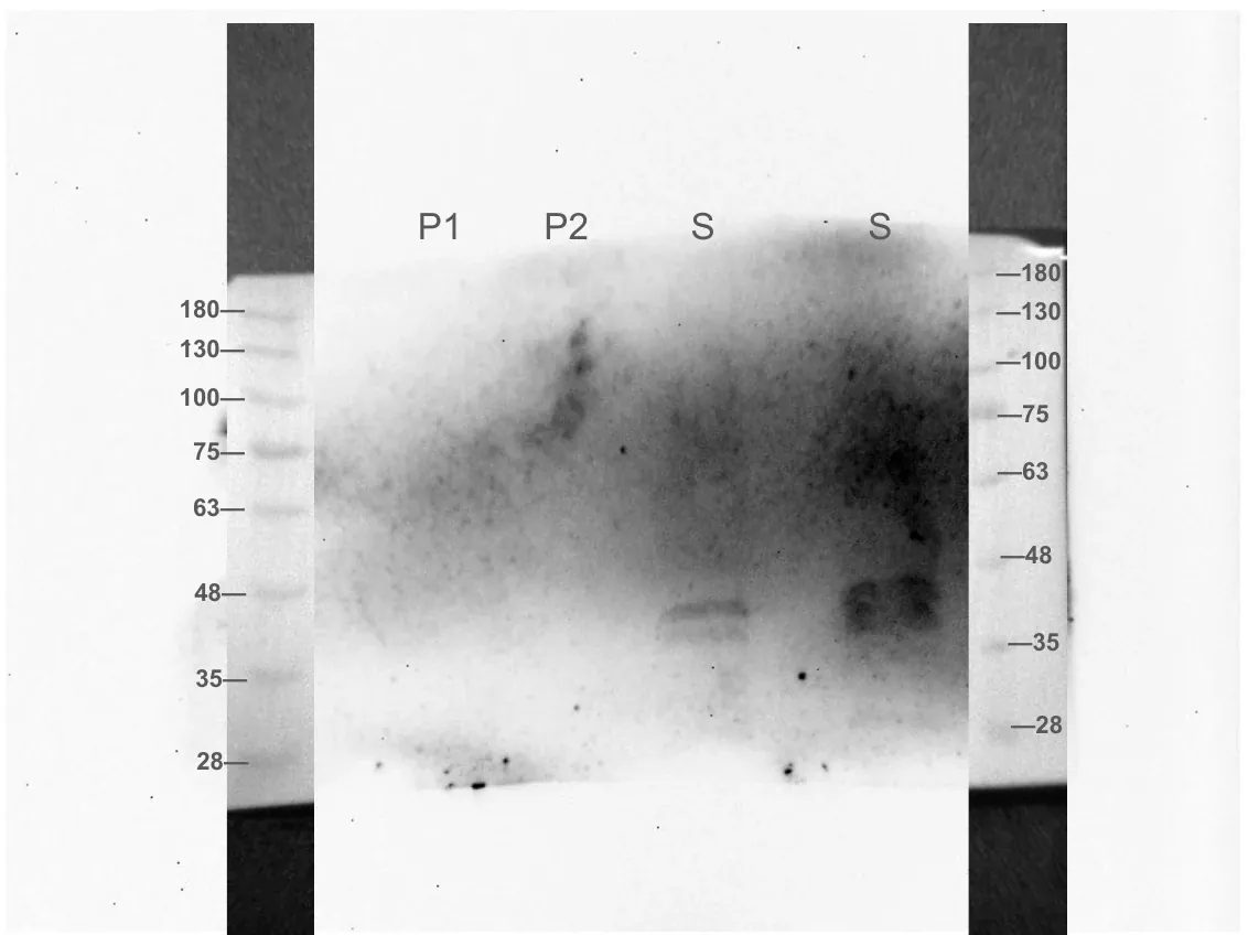 A Western blot of ACCD fractionation samples in lanes P1, P2 and S, with size ladders on both sides.