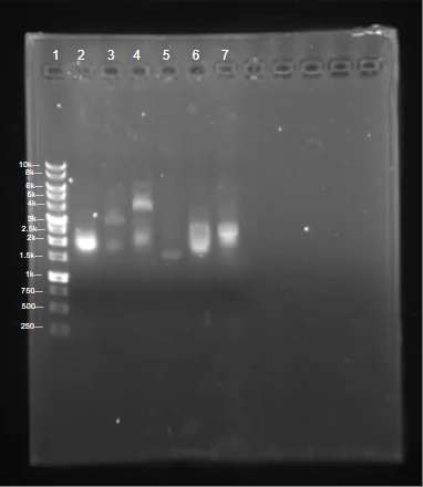 Agarose gel of seven lanes, a ladder and six sample lanes, with bright bands in lanes two, three, four, six and seven.