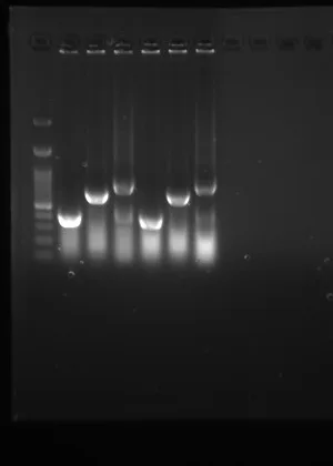 Agarose gel with a ladder and five sample lanes, each carrying two bands.
