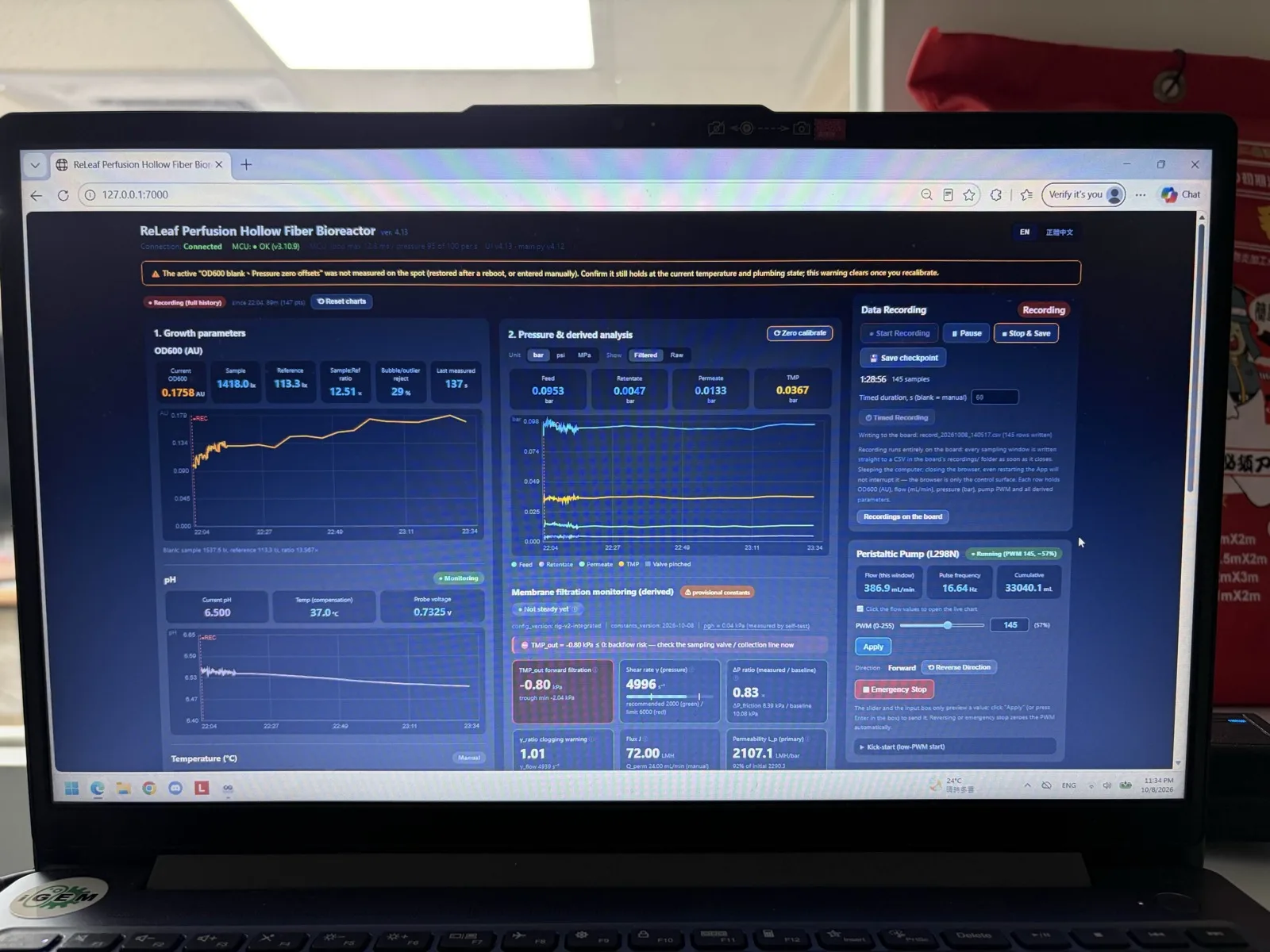 A laptop screen showing the Digital Twin dashboard during a run: optical density and pH charts, four pressure traces, membrane filtration values, data recording and pump controls.
