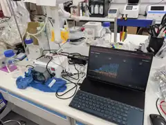 First live transmembrane pressure